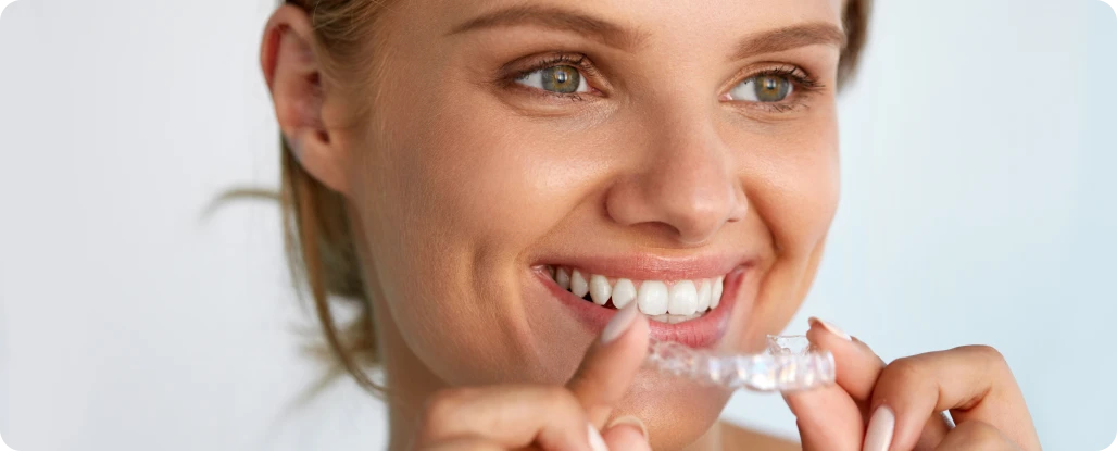 découvrez les avantages des gouttières invisibles pour un traitement orthodontique discret et confortable. obtenez un sourire parfait sans les inconvénients des appareils traditionnels. informations sur le coût, le fonctionnement et les conseils des experts.